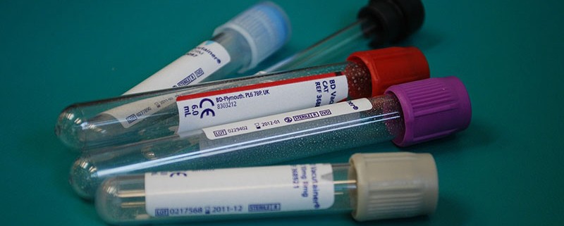 Legionelosis - I+D Control de Plagas